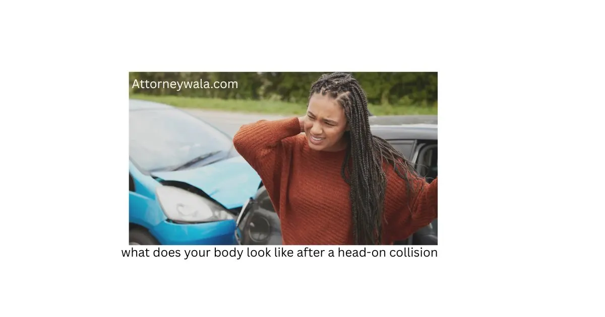 what does your body look like after a head-on collision