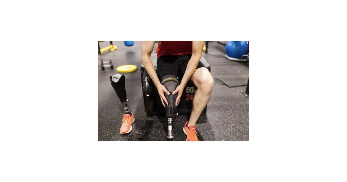 amputation injury attorney